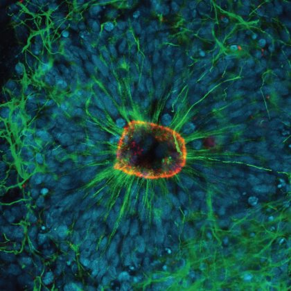 Red: Tight junction marker (Zo-1) demonstrating the apical surface. Green: Cytoskeleton marker (TUBB-3) showing the radial structure of the rosettes. Blue: Nucleus of cells (DAPI).